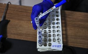 3_ekim_2021_turkiye_nin_koronavirus_tablosu_h18818_cb31b.jpg