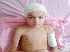 Sokak köpeklerinin saldırısında yaralanan Tunahan'ın ailesi